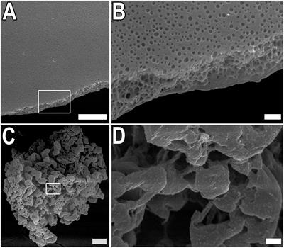 Effects of Recombinant Spidroin rS1/9 on Brain Neural Progenitors After Photothrombosis-Induced Ischemia